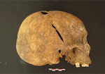 paleopatho.gif